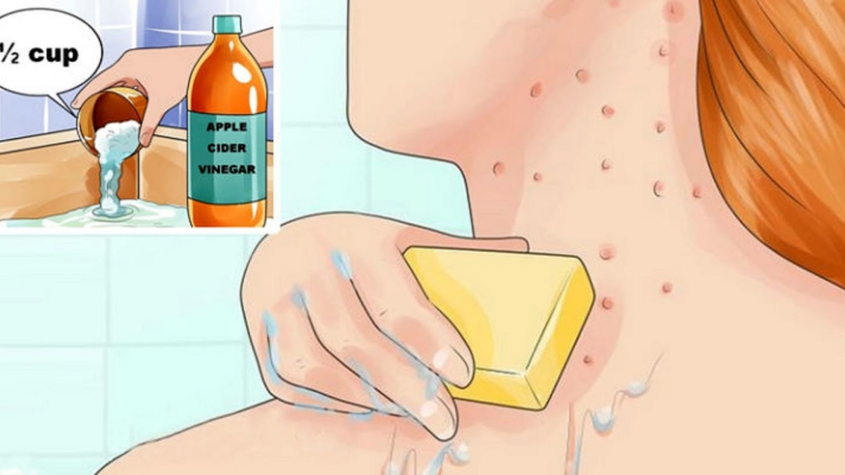 Mettezduvinaigredecidresurvotrevisageetvoircequiarrive252CEcz25C325A9maett25C325A2chesdevieillissementvontdispara25C325AEtretotalement