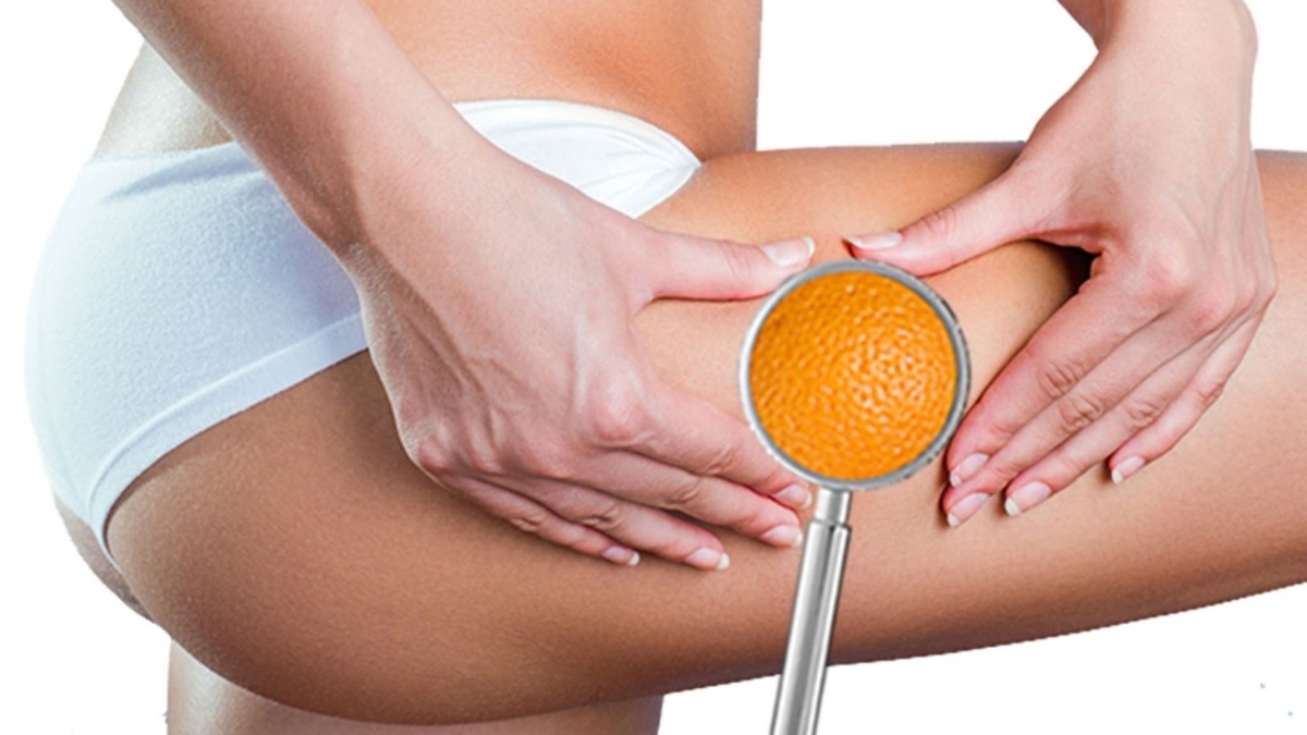 Pourr25C325A9duirelacellulite252Conprivil25C325A9gieleshuilesamincissantes252Canti-cellulite