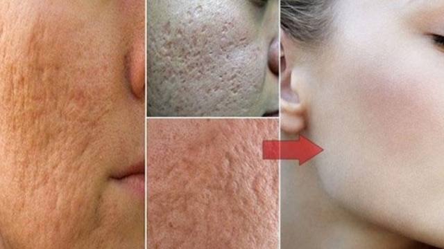 25C32589liminezvosverrues252Cvospointsnoirs252Clest25C325A2chessurvotrepeauetdevieillesseNaturellement